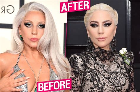 Did Lady Gaga Get Plastic Surgery? Exploring the Intersection of Art, Identity, and Speculation